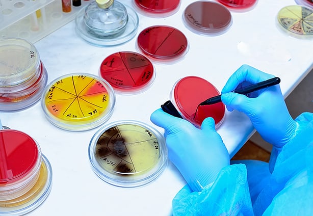 Petri dish. Microbiological laboratory. Mold and fungal cultures. Bacterial research